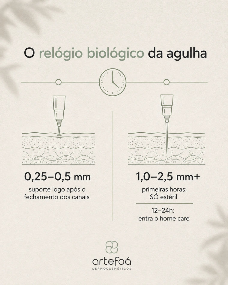 De 0,25 a 0,5 mm, o suporte entra logo após o fechamento dos canais. De 1,0 a 2,5 mm, as primeiras horas são só de estéril.